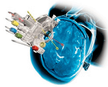 Image: MRI Interventions’ ClearPoint imaging system (Photo courtesy of MRI Interventions). Image: MRI Interventions’ ClearPoint imaging system (Photo courtesy of MRI Interventions).